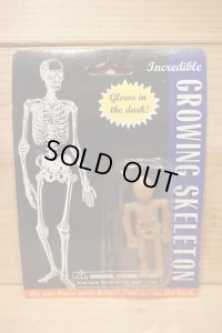 GROWING SKELETON 
