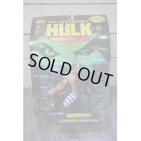 HULK TRANSFORMATIONS